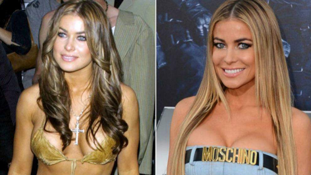 Carmen Electra Before and After Boob Job