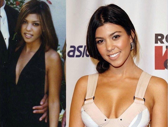 Kourtney Kardashian Before and After Boob Job