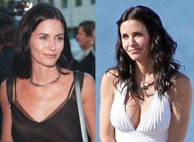 Courtney Cox Before and After Breast Surgery